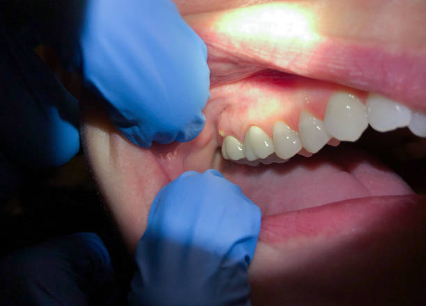 Best Broken or Chipped Tooth Repair in Archer, FL